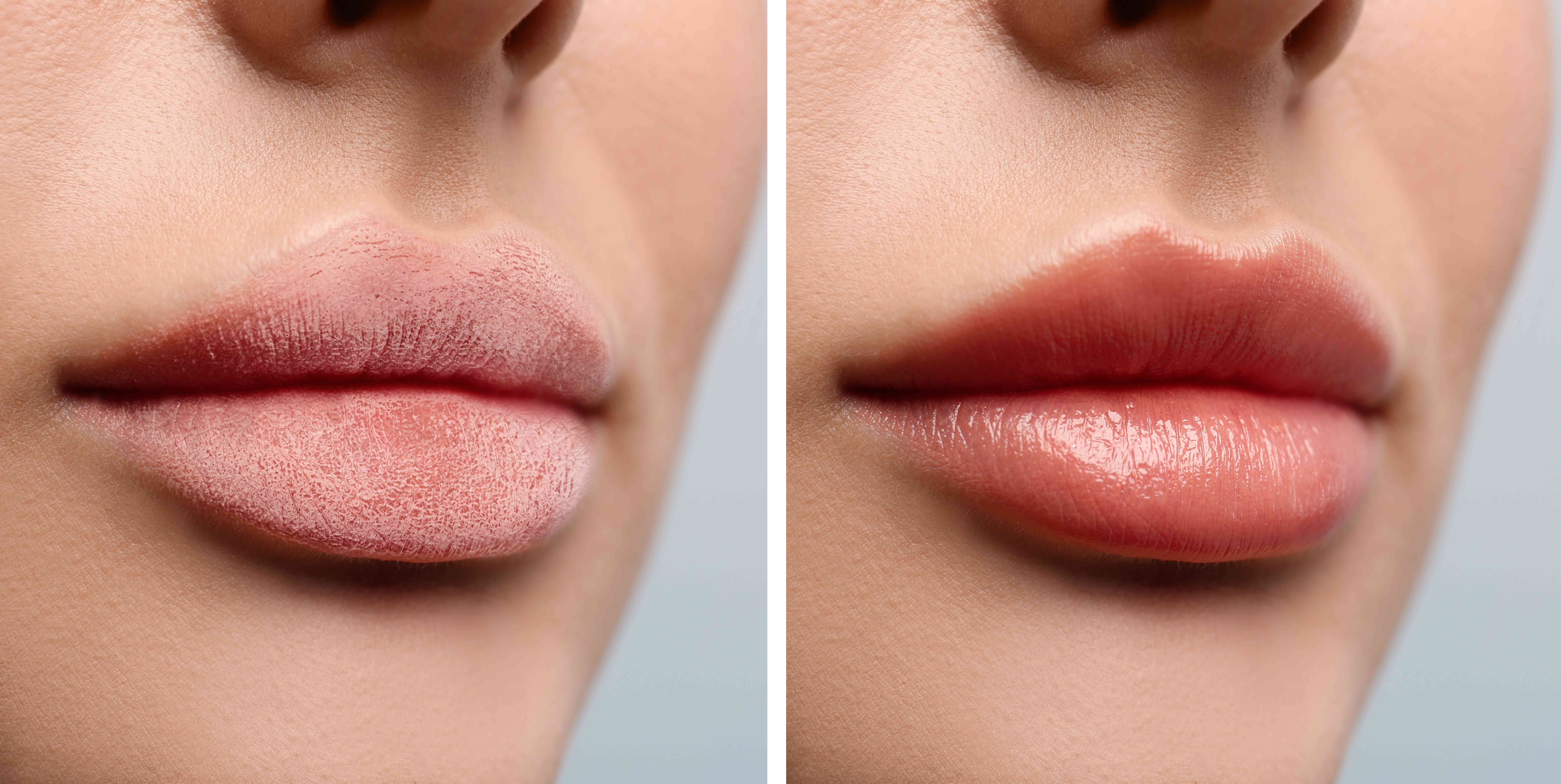 How to Keep Your Lips Soft and Moisturized: The Ultimate Guide