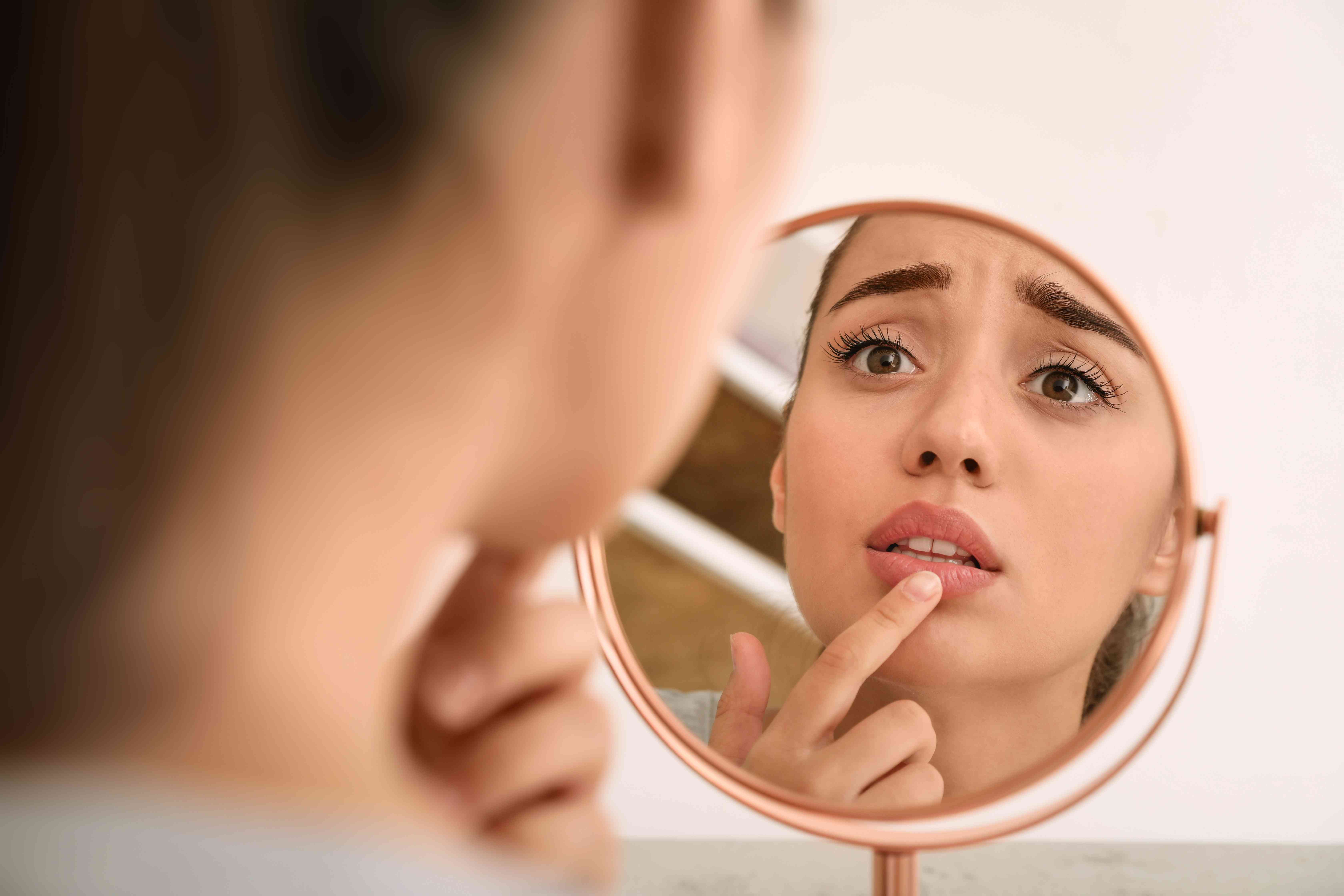 Natural Remedies for Chapped Lips: Simple Steps to Soften Them Up